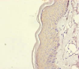 REEP5 Antibody