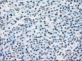 BRAF / B-Raf Antibody (clone OTI5A9)