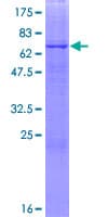 Human B3GNT6 Protein (Recombinant GST)