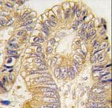 Polyclonal Rabbit anti-Human CLIC5 Antibody (IHC, WB)