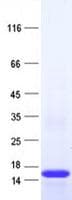 Human TOR1AIP2 Protein (Recombinant His, N-Terminal)