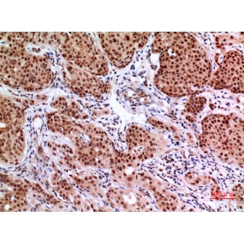 Polyclonal Rabbit anti-Human HIF2A / EPAS1 Antibody (380-420 aa, IHC, IF, WB)