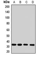 Rhodanese / TST Antibody