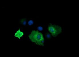 CTAG1B / NY-ESO-1 Antibody (clone OTI4G7)