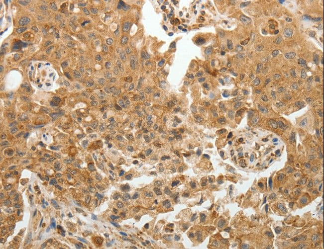 TFPI2 Antibody