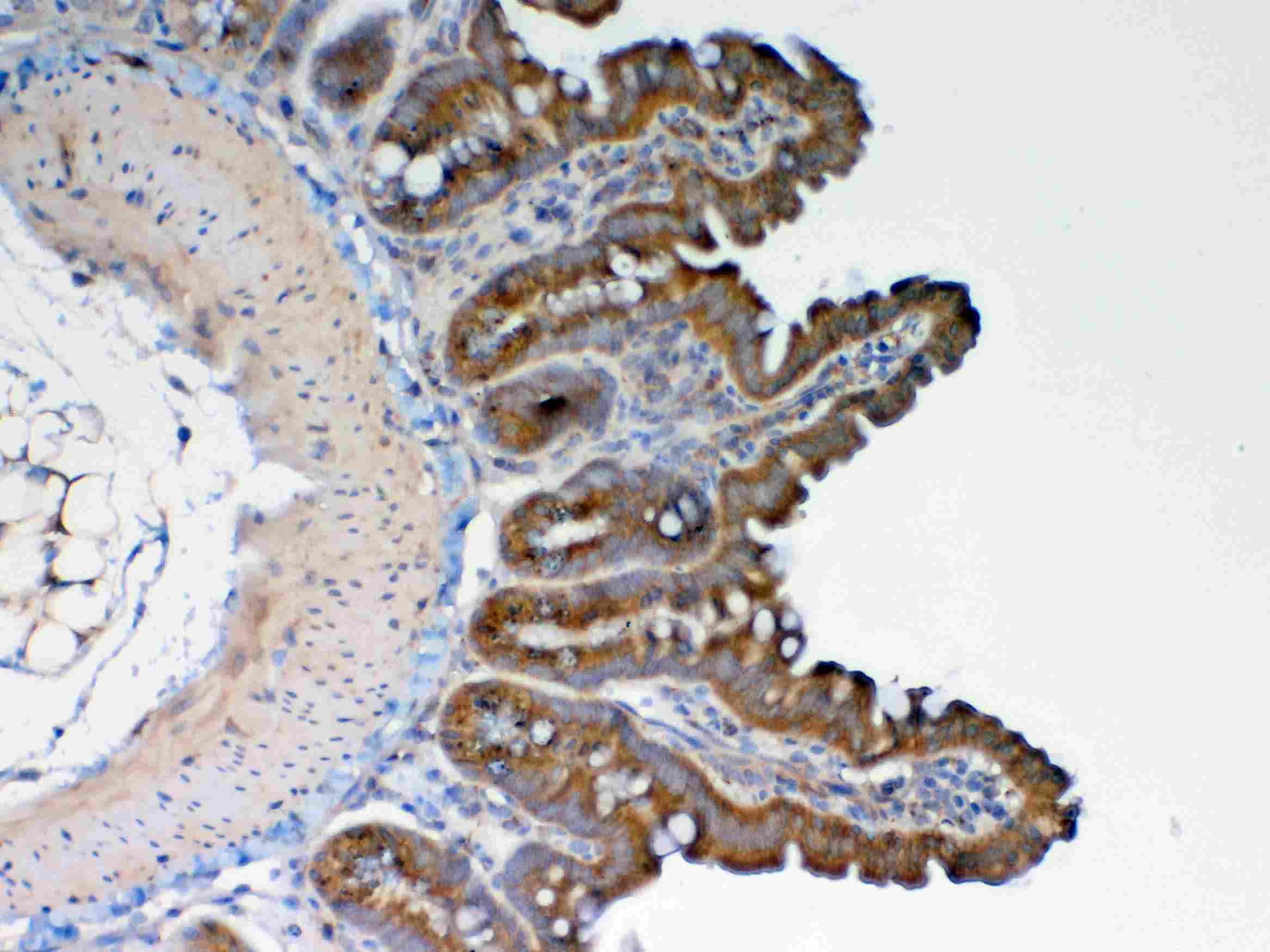 GALNS / Chondroitinase Antibody