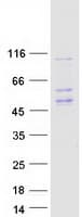 Human HLA-E Protein (Recombinant Myc-DDK (Flag))