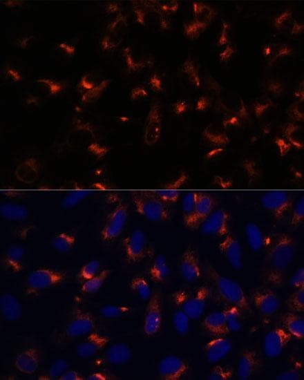 CCDC47 Antibody