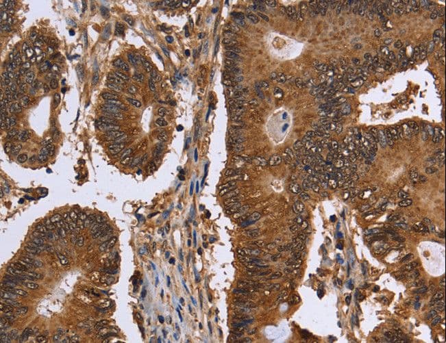 Polyclonal Rabbit anti-Human FANCF Antibody (IHC)