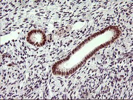 LMO2 Antibody (clone OTI1D7)