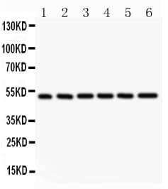 Polyclonal Rabbit anti-Human NFKB1 / NF-Kappa-B Antibody (aa1-360, IHC, WB)