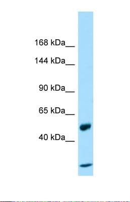 Polyclonal Rabbit anti-Human MACS / RIN2 Antibody (aa37-86, WB)