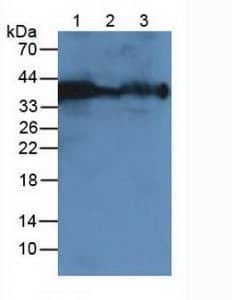 CA12 / Carbonic Anhydrase XII Antibody (aa161-318)