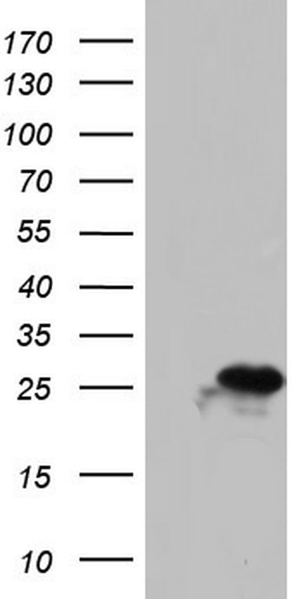 PAFAH1B3 Antibody (clone OTI4A9)