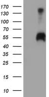Monoclonal Mouse anti-Human SPINT1 / HAI-1 Antibody (clone OTI4E3, IF, WB)