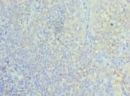 Polyclonal Rabbit anti-Human ASF1A Antibody (aa1-204, IHC, WB)