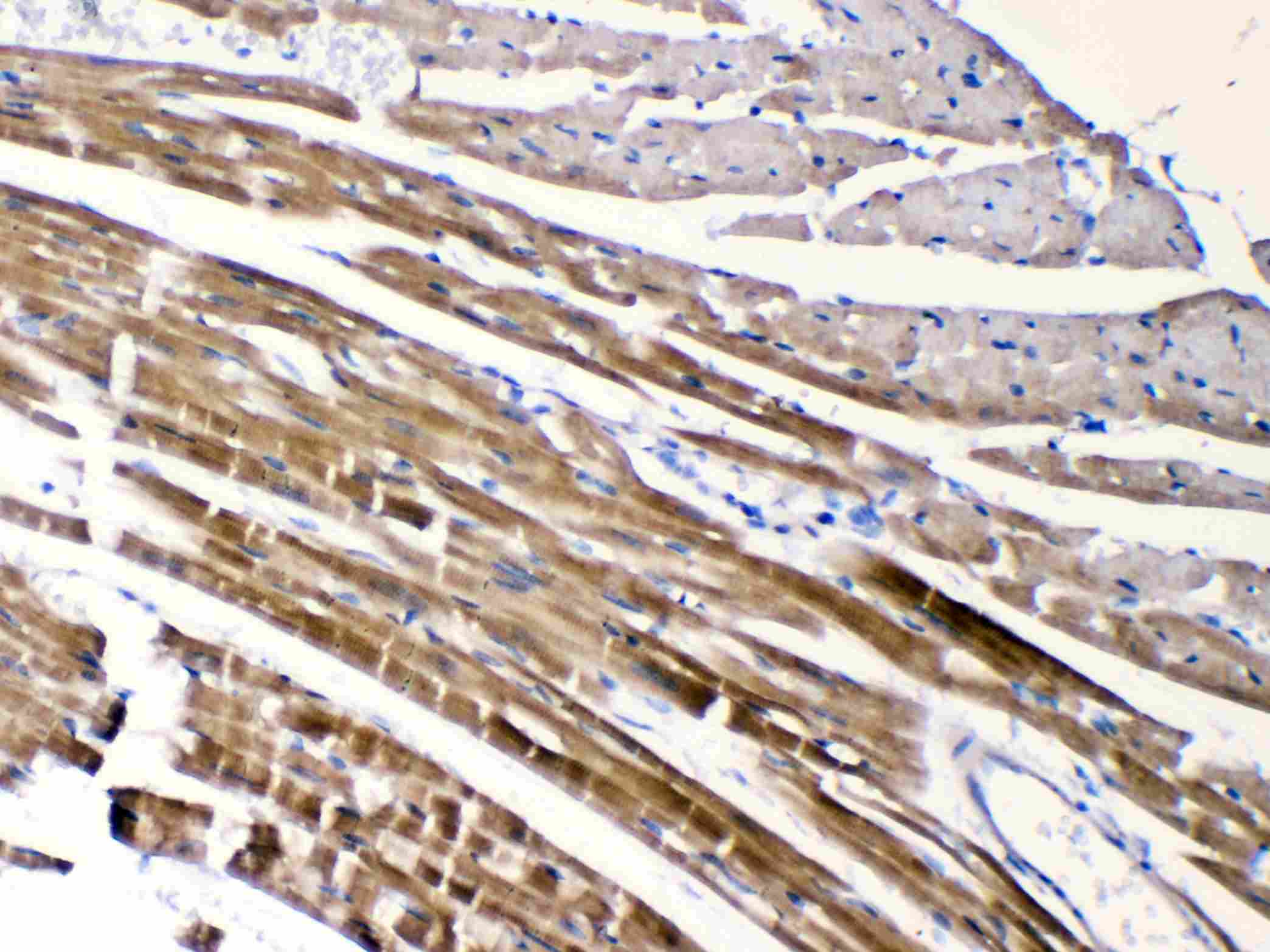 Polyclonal Rabbit anti-Human CHRNA5 Antibody (IHC, WB)