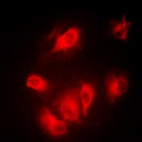 AURKA / Aurora-A Antibody (C-Terminus)