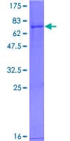 Human ACAA2 Protein (Recombinant GST)