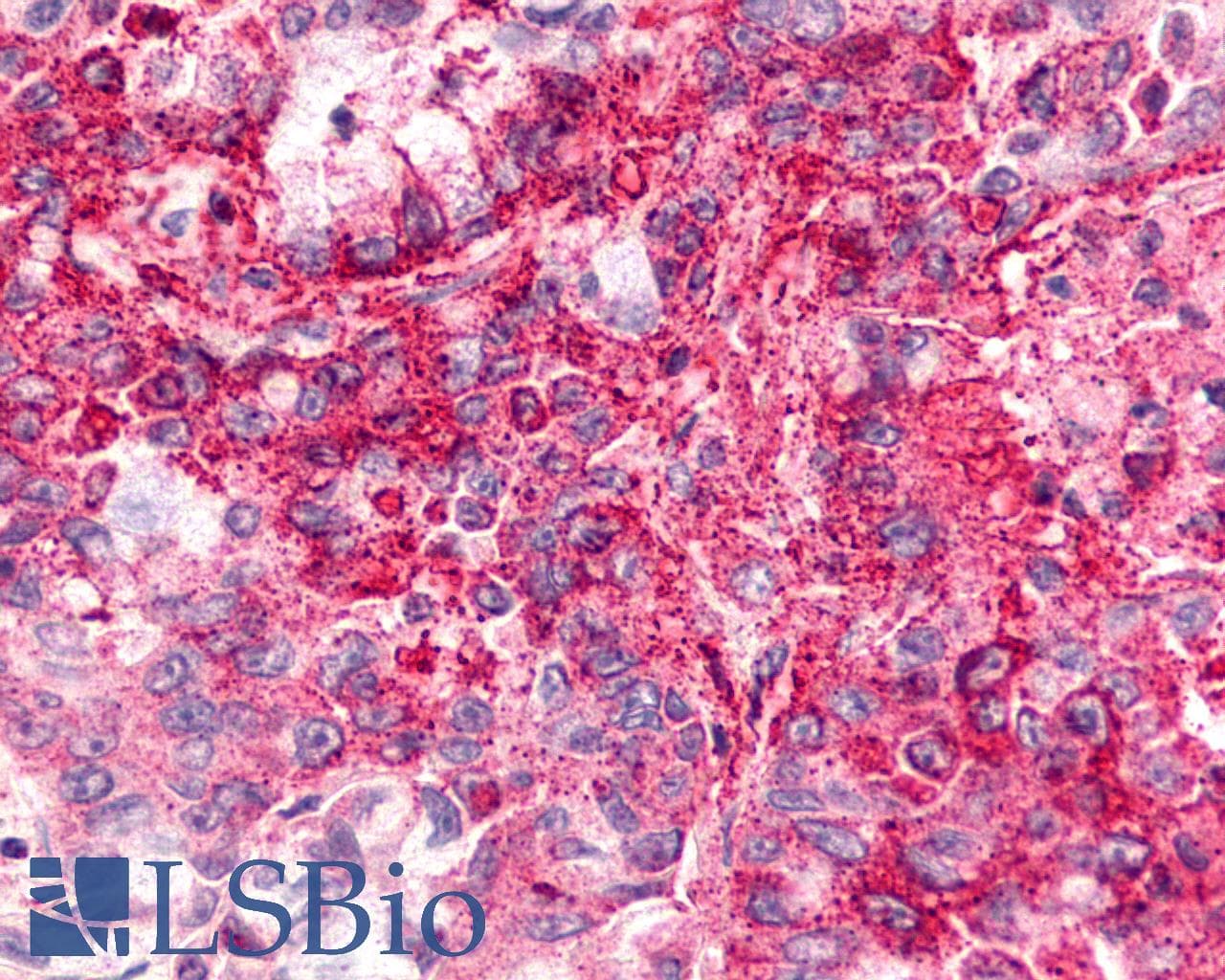 IHC-plus™ CXCR6 Antibody (C-Terminus)