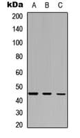 IHC-plus™ Polyclonal Rabbit anti-Human IDO2 / INDOL1 Antibody (Internal, IHC, WB)