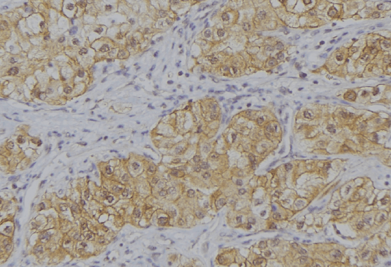 IL12B / IL12 p40 Antibody