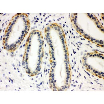 SLC6A4 / SERT Antibody (aa57-85)