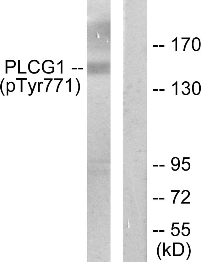 PLCG1 Antibody (phospho-Tyr771)