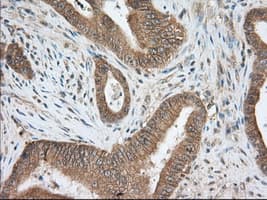 Monoclonal Mouse anti-Human PDE4A / PDE4 Antibody (clone OTI6D6, IHC, IF, WB)