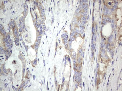 MTDH / Metadherin Antibody (aa70-582, clone OTI2F11)