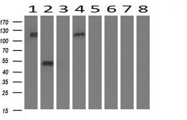 FGFR2 / FGF Receptor 2 Antibody (clone OTI1D3)