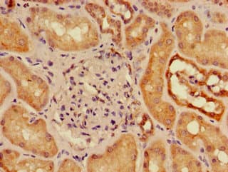 SLC16A9 Antibody