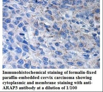Polyclonal Rabbit anti-Human ARAP3 Antibody (aa6-204, IHC, WB)