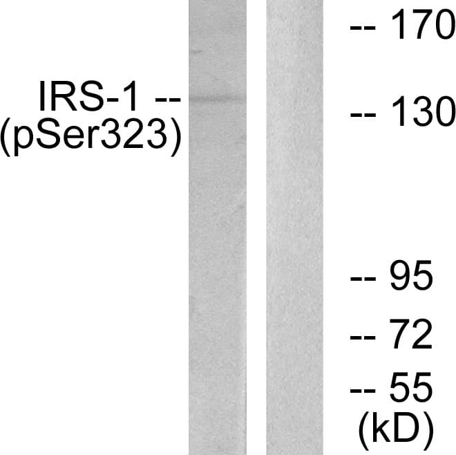 IRS1 Antibody (phospho-Ser323)