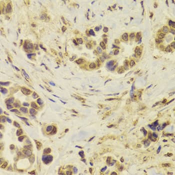 Polyclonal Rabbit anti-Human DOK1 Antibody (IHC, WB)