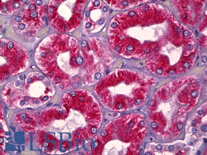 IHC-plus™ Polyclonal Rabbit anti-Human UBE1DC1 / UBA5 Antibody (aa281-330, IHC, WB)