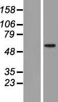 TRIM17 / RNF16 Protein (Over-Expression Lysate Myc-DDK (Flag))