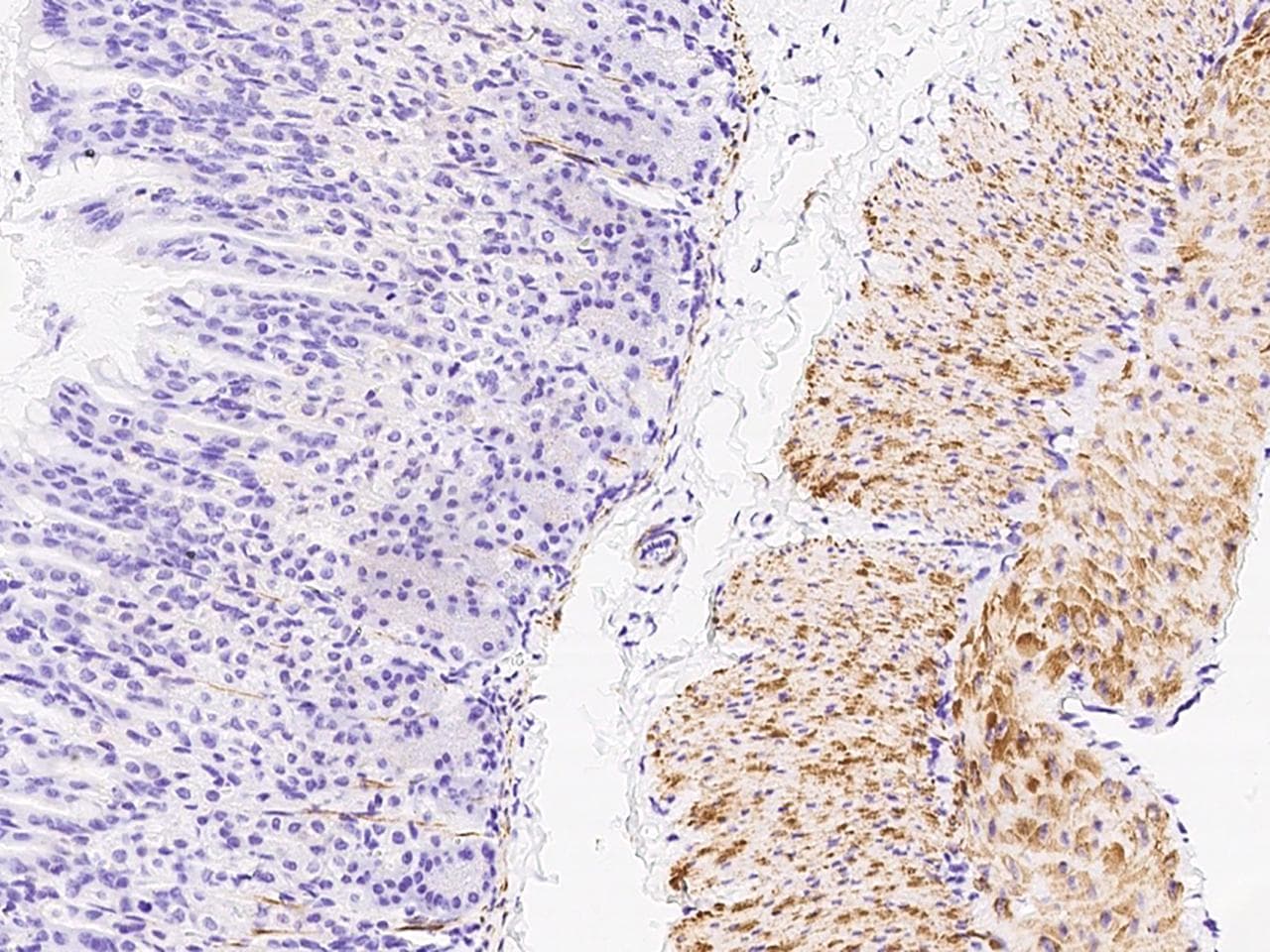 DES / Desmin Antibody (Preservative Free)