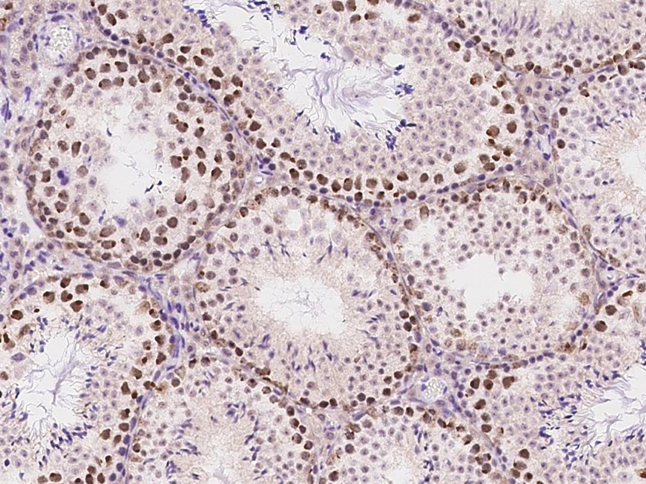 ATR Antibody