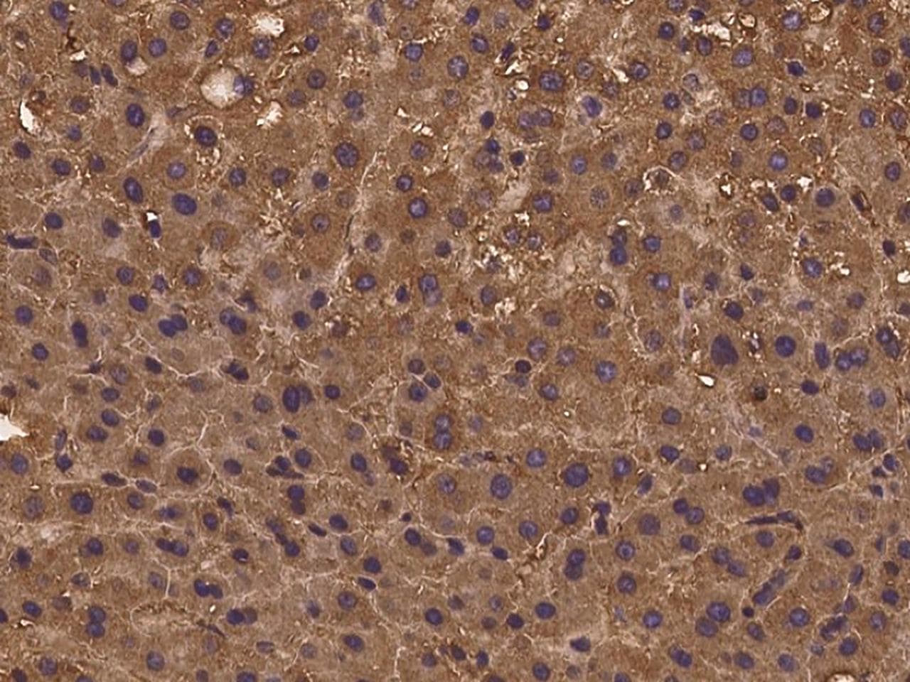 Polyclonal Rabbit anti-Human PSMG3 Antibody (IHC)