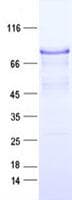 Human CTTN / Cortactin Protein (Recombinant DDK,C-terminus)