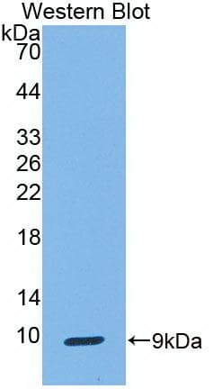 SCGB1A1 / Uteroglobin Antibody (clone C2)