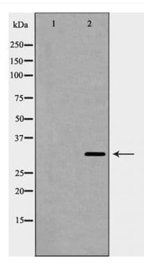 BAG1 / BAG-1 Antibody