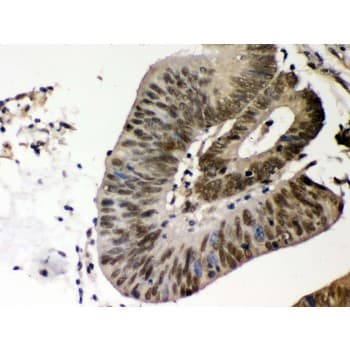 CSNK1A1 / CK1 Alpha Antibody (aa30-68)