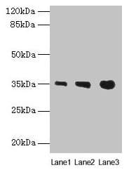 PVRIG Antibody