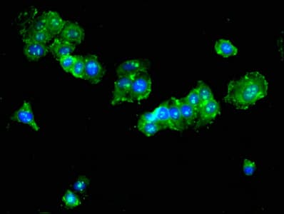 Tyrosine Aminotransferase Antibody