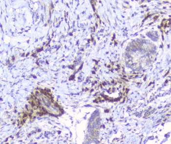 ERGIC-53 / LMAN1 Antibody