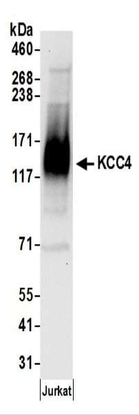 SLC12A7 / KCC4 Antibody (aa1-50)