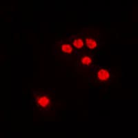 Polyclonal Rabbit anti-Human REV3L / REV3 Antibody (aa246-285, IHC, IF, WB)