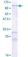 Human NUAK1 / ARK5 Protein (Recombinant GST)